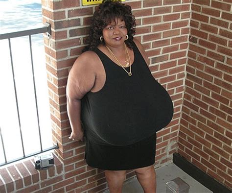 La femme aux plus gros seins du monde ? 18 kilos de poitrine ! La femme aux plus gros seins du monde ? 18 kilos de poitrine !